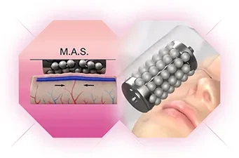 Cellusphere Micro-vibration