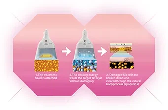 Cryolipolysis